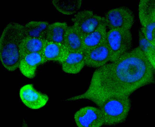 STAT1 alpha Rabbit mAb