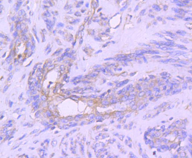 STAT1 alpha Rabbit mAb