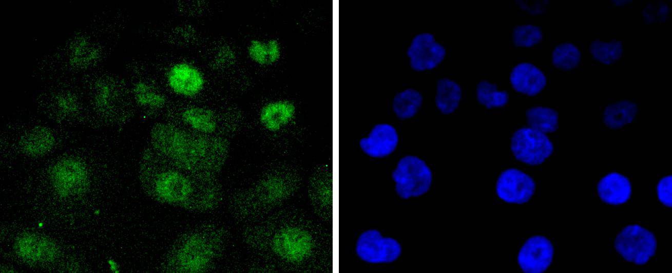 Cdk4 Rabbit mAb