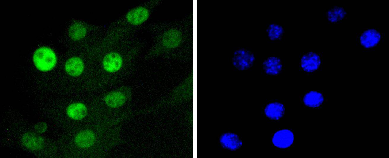 Cdk4 Rabbit mAb