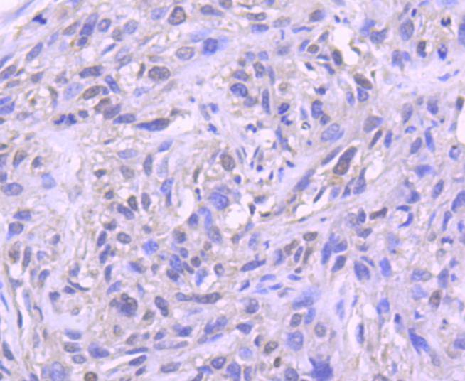 Histone H1.0 Rabbit mAb