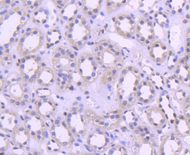 Histone H1.0 Rabbit mAb