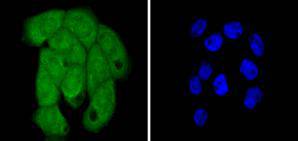 Histone H2B Rabbit mAb