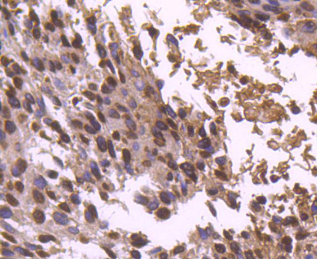 Histone H2B Rabbit mAb