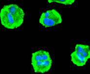 PDPK1 Rabbit mAb