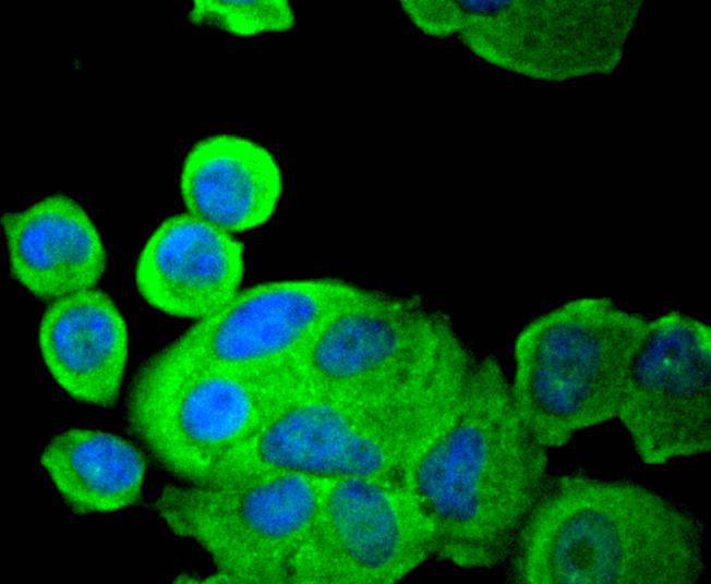 PDPK1 Rabbit mAb