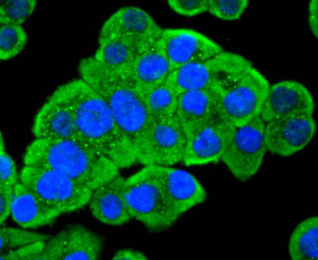 PDPK1 Rabbit mAb