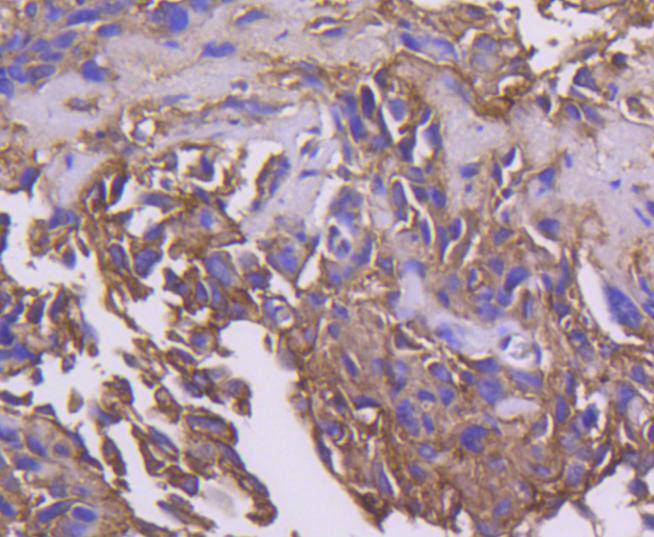 PDPK1 Rabbit mAb