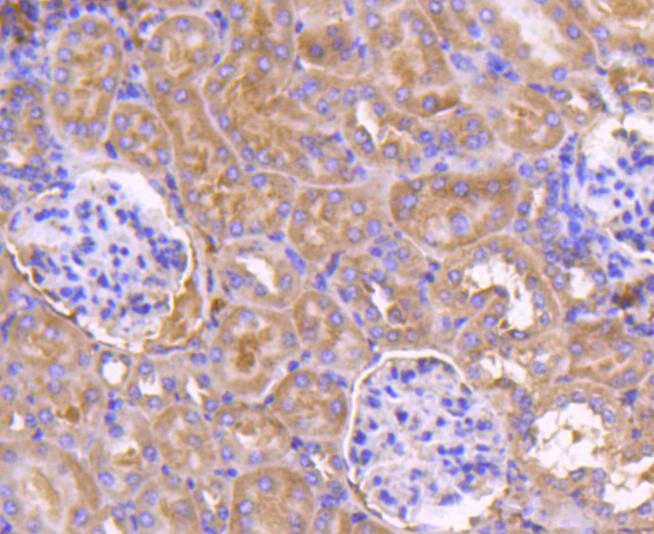 PDPK1 Rabbit mAb