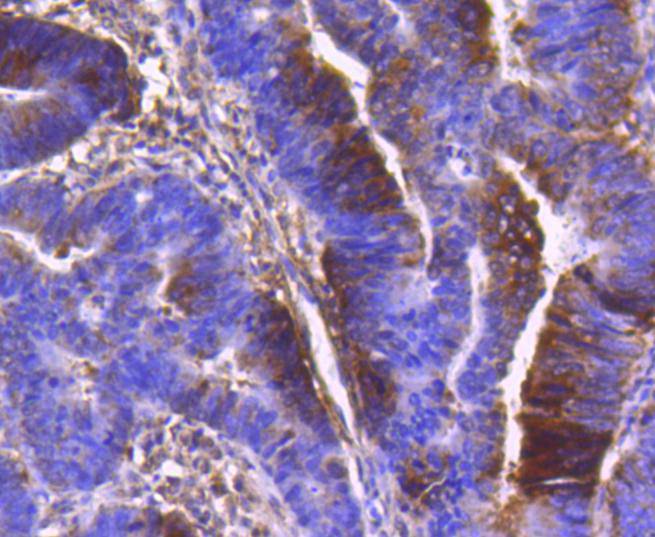 PDPK1 Rabbit mAb