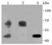 PDPK1 Rabbit mAb