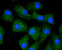 Caspase 5 Rabbit mAb