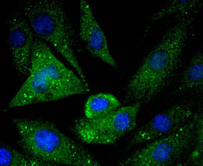 Caspase 5 Rabbit mAb