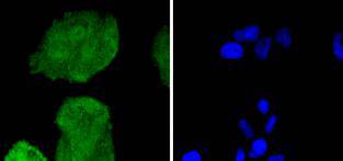 Cdk6 Rabbit mAb