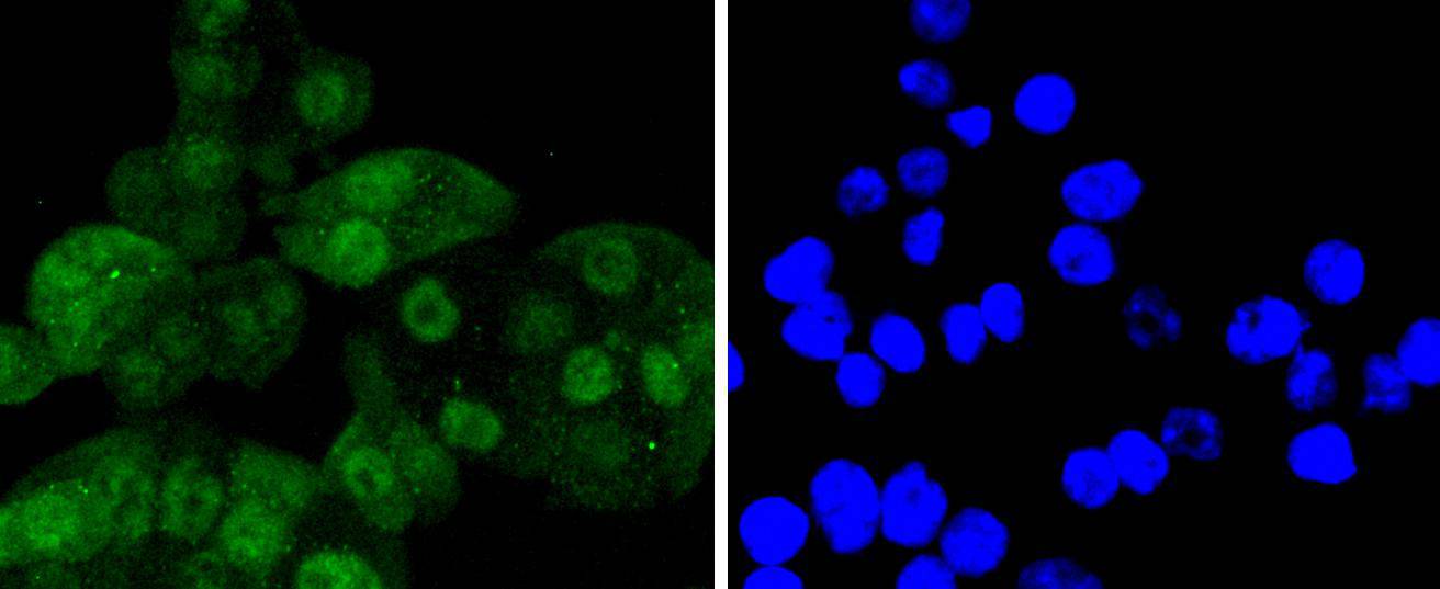 Cdk6 Rabbit mAb