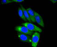 AP2M1 Rabbit mAb