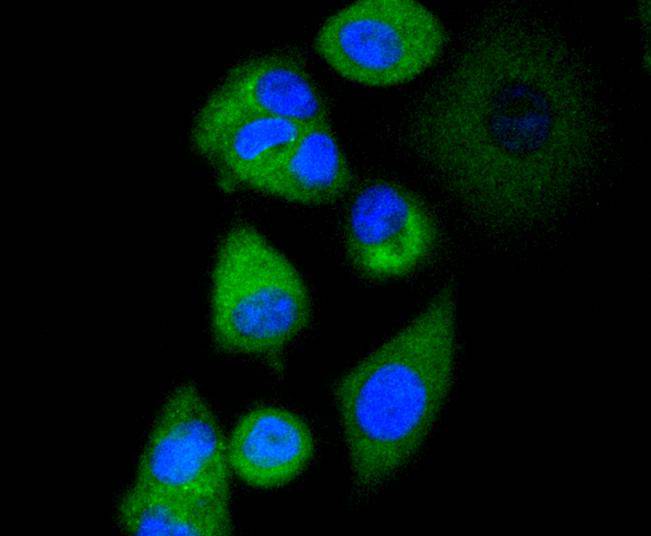 AP2M1 Rabbit mAb