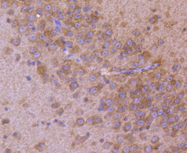 AP2M1 Rabbit mAb