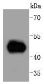 MEK5 Rabbit mAb