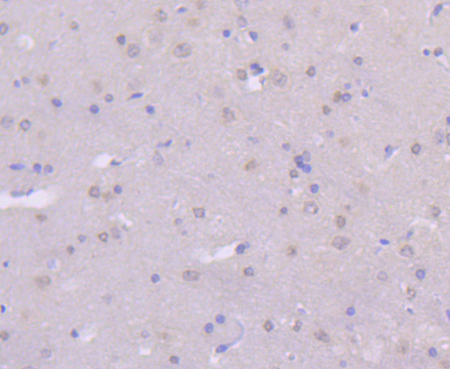 MEK7 Rabbit mAb