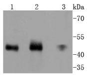 MEK7 Rabbit mAb