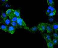 IRF6 Rabbit mAb