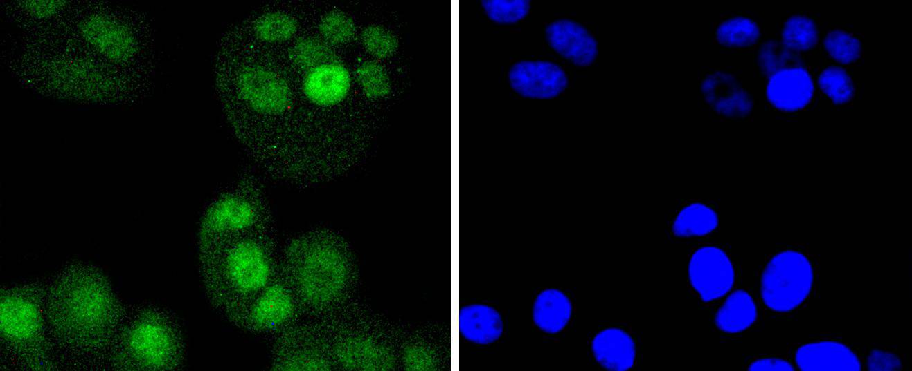 IRF6 Rabbit mAb