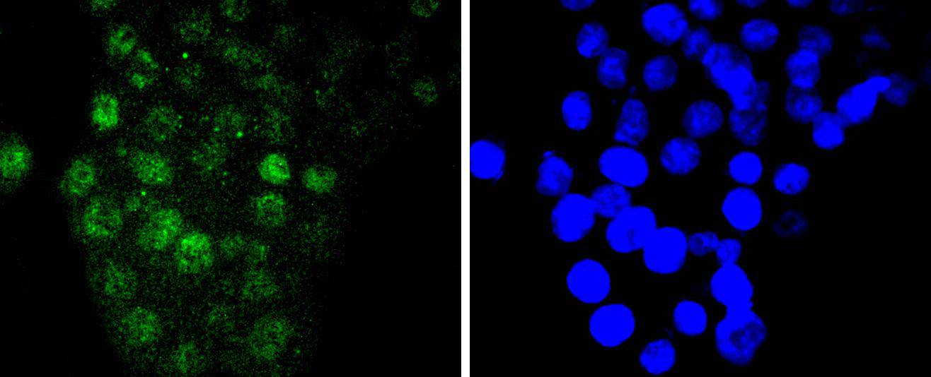 IRF6 Rabbit mAb