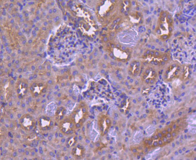 IRF6 Rabbit mAb