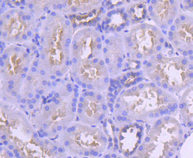 IRF6 Rabbit mAb