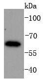 IRF6 Rabbit mAb