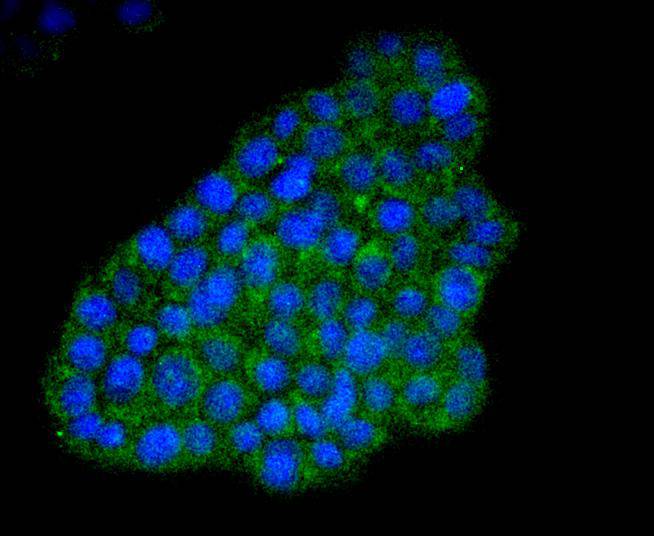 ATF4 Rabbit mAb