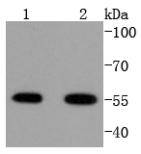 ATF4 Rabbit mAb