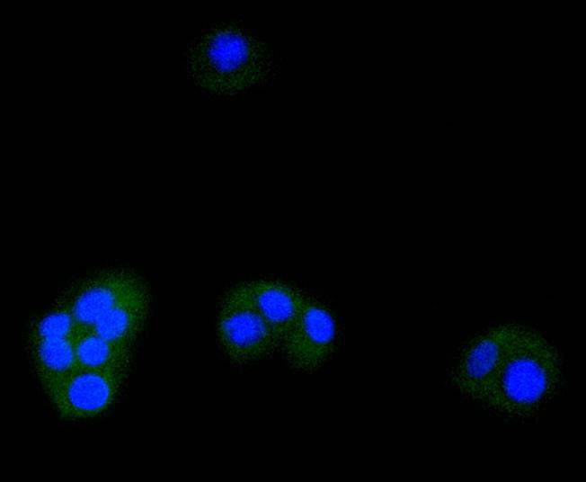 ATF5 Rabbit mAb