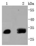 ATF5 Rabbit mAb