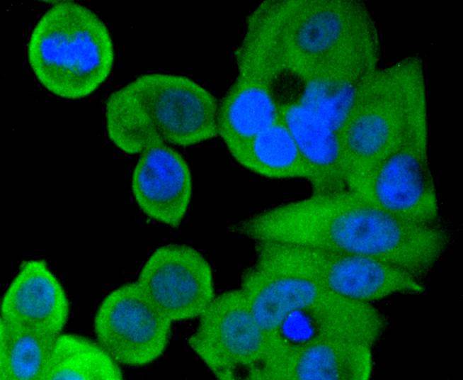 Smad1 Rabbit mAb