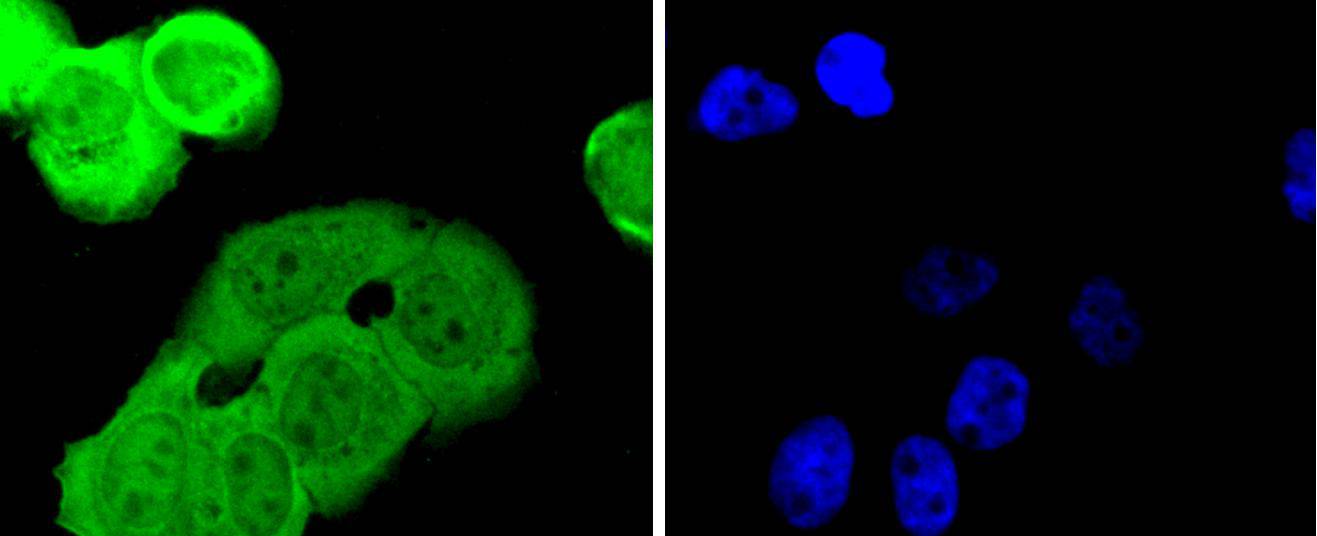 Smad1 Rabbit mAb