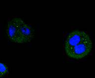 Cyclin D3 Rabbit mAb