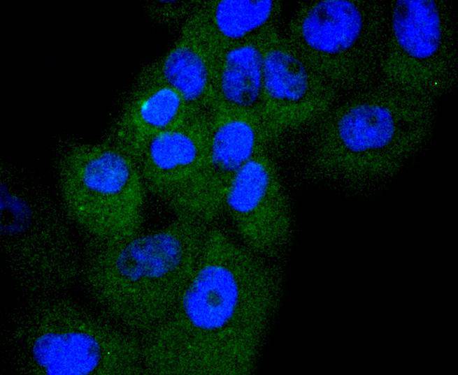 Cyclin D3 Rabbit mAb