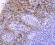 14-3-3 sigma Rabbit mAb