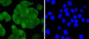 IRS1 Rabbit mAb