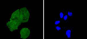 IRS1 Rabbit mAb