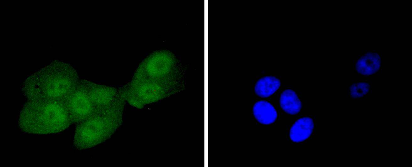 IRS1 Rabbit mAb