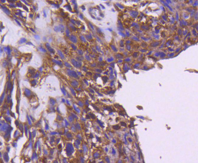 IRS1 Rabbit mAb