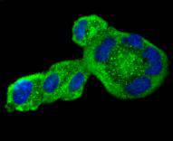 Angiotensinogen Rabbit mAb