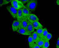 Angiotensinogen Rabbit mAb