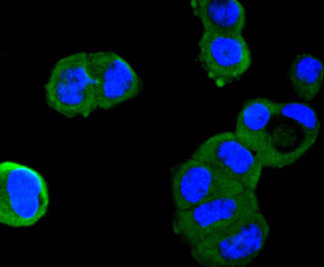 Angiotensinogen Rabbit mAb