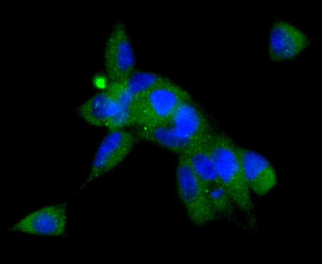 Angiotensinogen Rabbit mAb