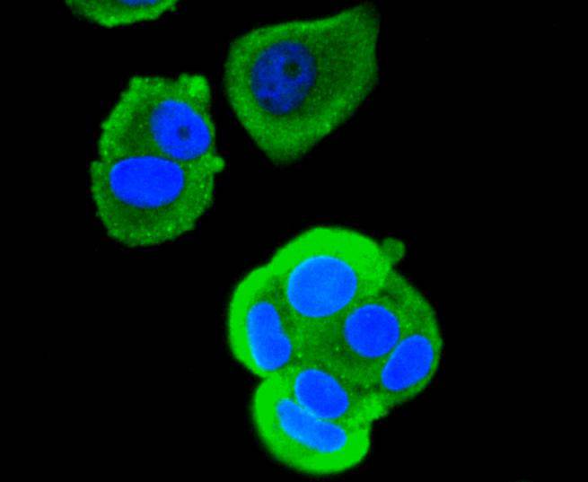 RUNX1+RUNX2+RUNX3 Rabbit mAb