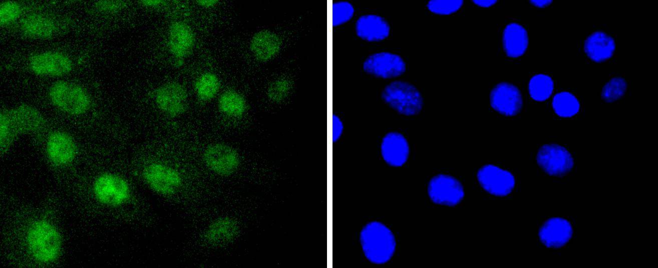 RUNX1+RUNX2+RUNX3 Rabbit mAb